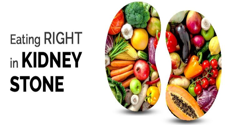 what-to-eat-kidney-stone