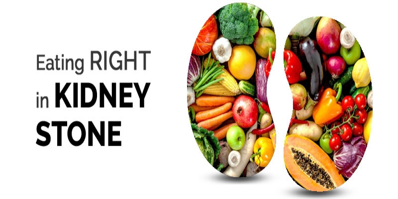 what-to-eat-kidney-stone