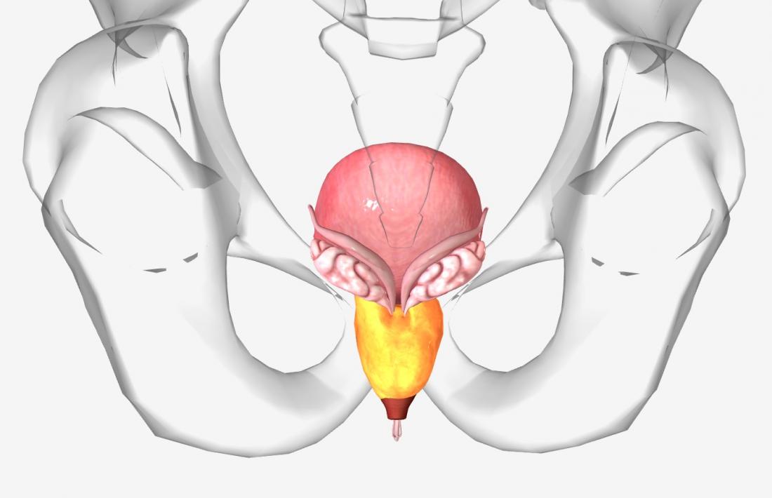 Enlarge-Prostate-Treatment