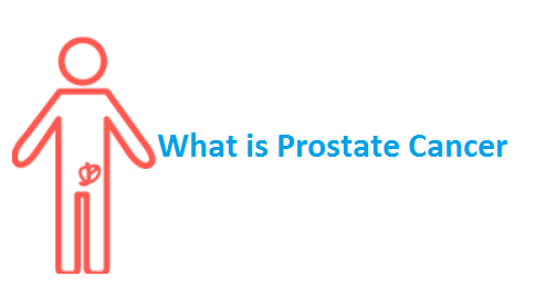 What-is-prostate-cancer?